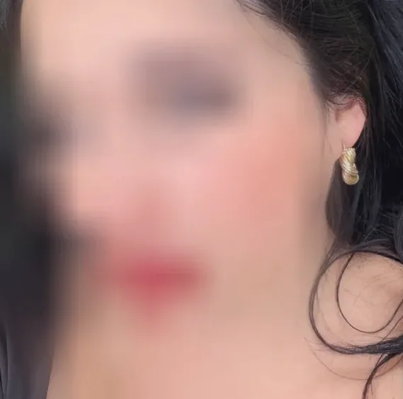 Chiara, 37